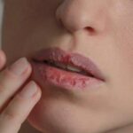 10 Best Essential Oils For Chapped Lips ⋆ BeautyNews