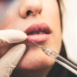 How dermal fillers can complement your natural beauty