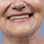 Age is just a number for tooth alignment