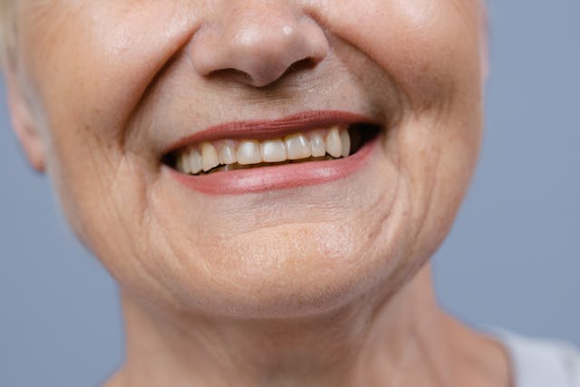 Age is just a number for tooth alignment