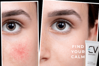 7 questions and answers about hypersensitive skin