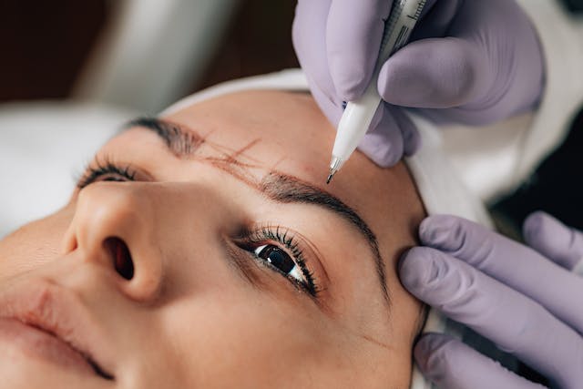 When should you think about a brow lift?