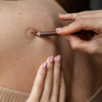 How to Heal Smart After Skin Cancer Surgery