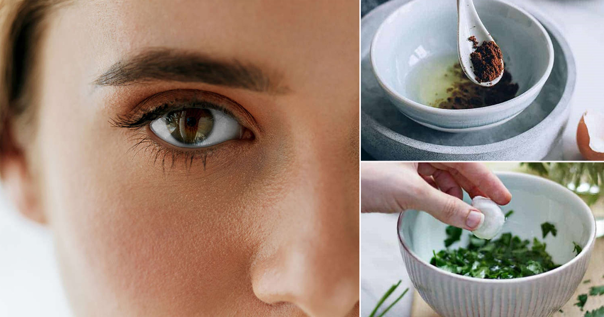 12 DIY Eye Mask Recipes to get swollen eyes and dark circles