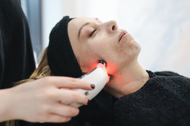 Holistic approaches to ACNE treatment: From nutrition to dermatology