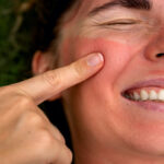 Sunscreen first aid -aid – 7 common mistakes that you will regret later