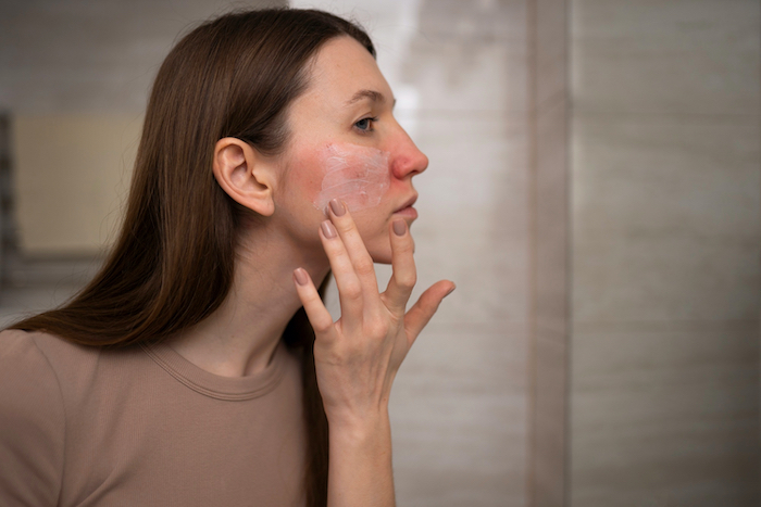 Auto -immune diseases Skin care: What to avoid