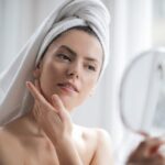 Best Post-Acne Routines To Prevent Scarring With Calecim