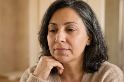 If you have both pimples and fine lines, what could be the connection between the two?