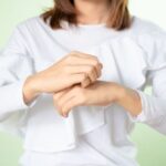 Eczema flare-up